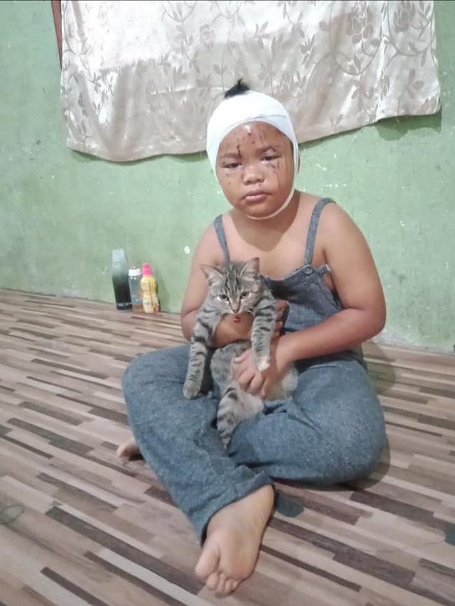 Wajahnya Sering Dicakar, Bocah Ini Tetap Rawat dan Sayang Kucingnya