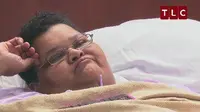 Milla Clark, seorang istri dan ibu dari 4 anak mengalami obesitas dan tidak dapat bangun dan berjalan selama kurang lebih dua tahun.