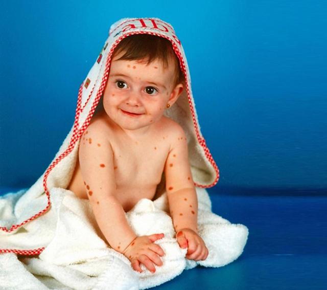 Alba saat masih bayi | Photo: Copyright thesun.co.uk