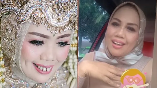 6 Transformasi Seleb Setelah Perbaikan Gigi, Terbaru Elly Sugigi