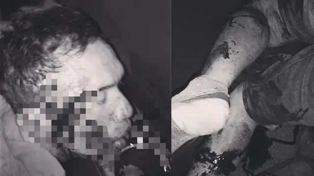 Polisi Jambi Tewas Ditembak