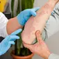 Seorang dokter sedang memeriksa kulit pasien yang mengalami psoriasis. (FussSergei/depositphotos.com)