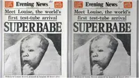 25-7-1978: Lahirnya Bayi Tabung Pertama di Dunia