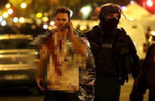 Salah satu korban serangan teror di Paris | Photo: Copyright unilad.co.uk 