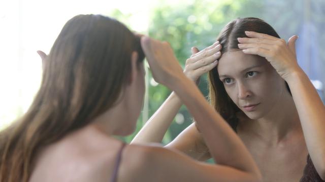 Tips Melembapkan Kulit Kepala Kering untuk Dukung Kesehatan Rambut