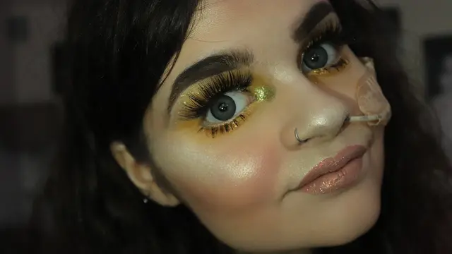 [Fimela] Kisah beauty vlogger yang harus menggunakan selang makanan seumur hidup