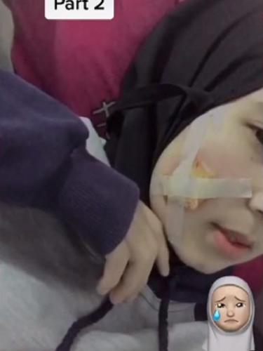 Viral Curhatan Wanita Berjerawat Hingga Harus Dioperasi Karena Pakai Masker Kain Citizen6 Liputan6 Com