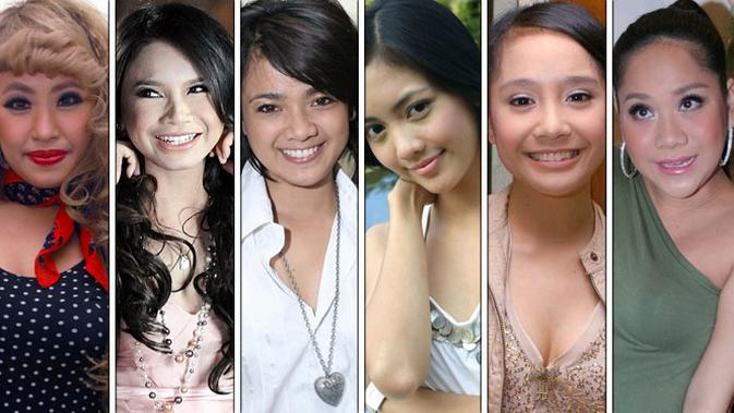 Tetap Cantik Artis Artis Ini Memiliki Hidung Tak Mancung Showbiz Liputan6 Com