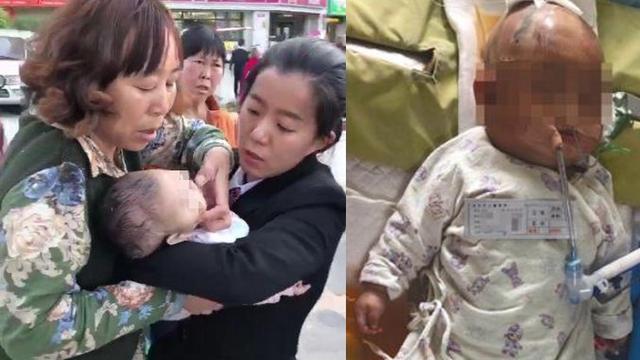 Bayi Mengalami Koma, Setelah Tertimpa Buah Apel yang Terjatuh dari Lantai 24