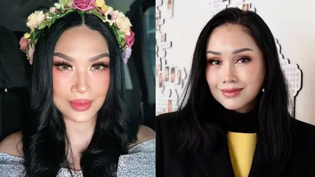Beda Penampilan 9 Artis Sebelum vs Setelah Operasi Plastik, Bikin Pangling