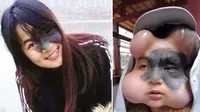 Akibat kanker tahi lalat, wajah gadis asal China ini menjadi mirip boneka anime "Calabash" (Sumber foto: worldofbuzz3.com)