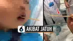 Bocah asal China usia 2 tahun harus dilakukan operasi besar, akibat tusukan sate menembus sampai ke otaknya. Ini disebabkan saat ia makan sate sosis dan terjatuh.