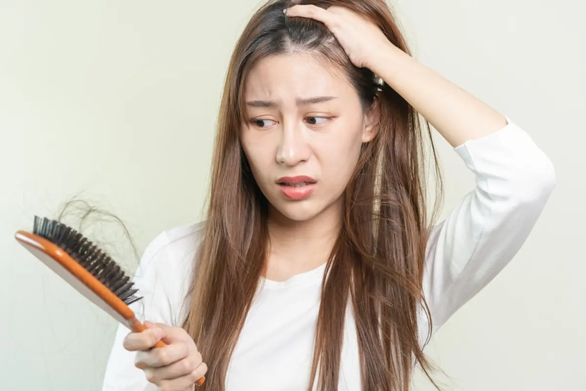 Rambut Rontok Parah Hingga Sebabkan Kebotakan? Ketahui Penyebab dan Cara Mengatasinya dengan Mudah