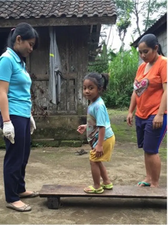 YPK Bali konsisten memberi terapi ke anak-anak difabel (Foto: Mina Megawati)