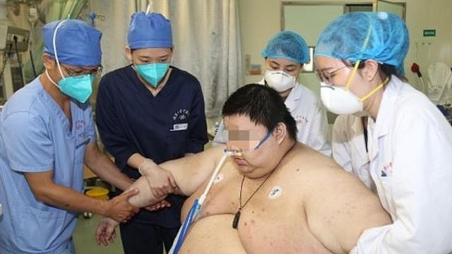 berat badan naik drastis selama lockdown