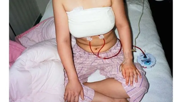 [Bintang] Sebelum Berhasil Jadi cantik, Proses Mengerikan Ini Harus Dilalui oleh Mereka yang Operasi Plastik