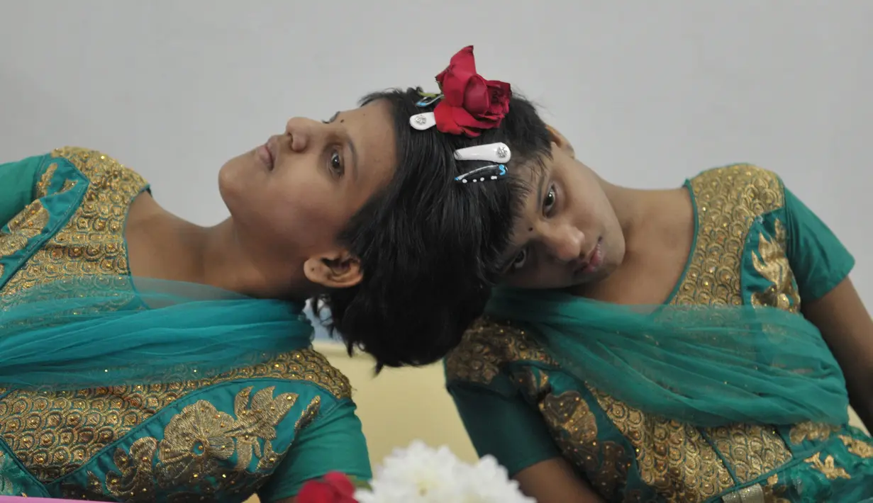 Veena (kanan) dan Vani saat berada di Rumah Anak di Hyderabad, India (2/1). Mereka telah dipindahkan dari fasilitas perawatan ke lingkungan masyarakat supaya dapat meningkatkan pembangunan pendidikan dan sosial mereka. (AFP/Noah Seelam)