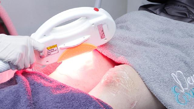 Menghilangkan bekas luka