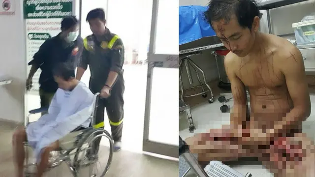 Bergairah Nonton Porno. Pria ini Potong Penisnya Sendiri