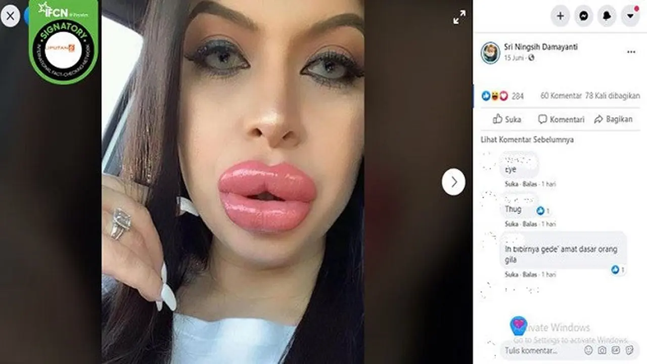 Gambar Tangkapan Layar Foto Wanita Dengan Bibir Bengkak (foto: Facebook)
