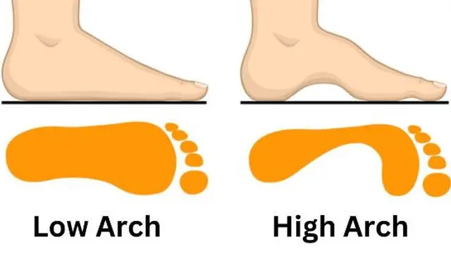Ketahui Kepribadian Berdasarkan Lengkungan Telapak Kaki, Kamu Tipe yang Mana?