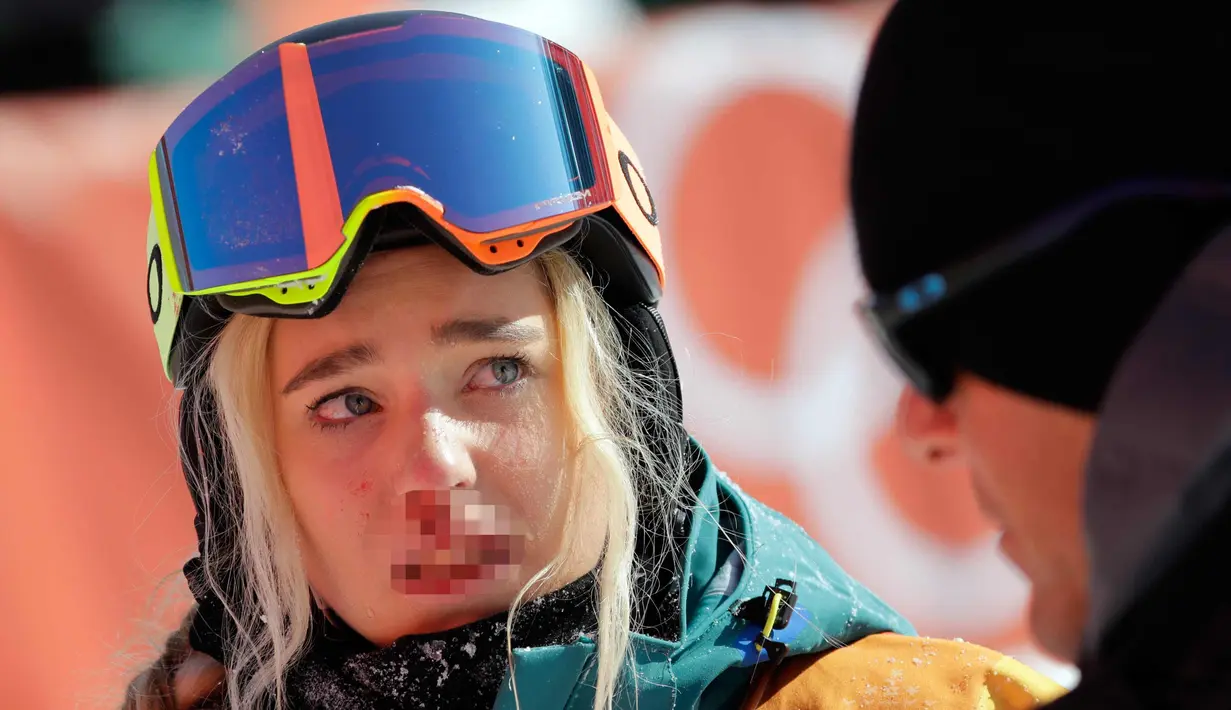 Ekspresi Emily Arthur dengan hidung berlumuran darah setelah terjatuh dalam pertandingan semifinal halfpipe putri pada Olimpiade Musim Dingin 2018 di Pyeongchang, Korea Selatan, (13/2). (AP Photo / Gregory Bull)