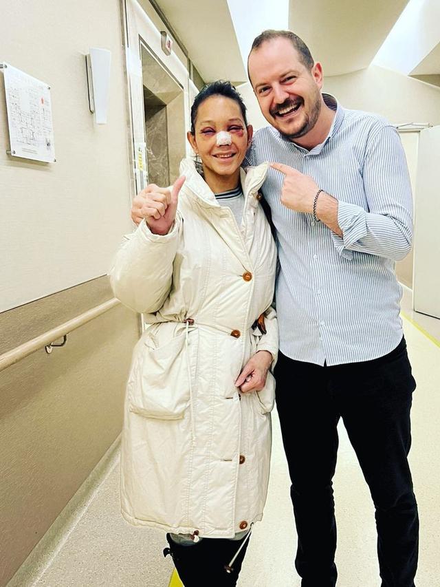 Bunda Corla Operasi Plastik, Ini 6 Potretnya dengan Perban dan Wajah Lebam