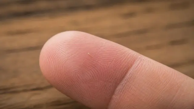 Splinter