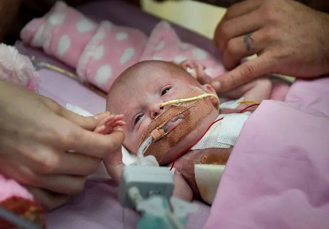 Bayi Inggris ini terlahir dengan jantung di luar tubuh dan langsung dioperasi. (University Hospitals of Leicester NHS Trust/PA Wire)
