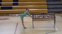 Seorang penari cilik perempuan tetap bersemangat mengikuti lomba menari walaupun satu kakinya telah mengalami amputasi. 