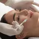 Ilustrasi perawatan wajah skin booster. (Iakovenko123/DepositPhotos.oom)
