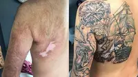 Gunakan Tato Untuk Menutupi Bekas Luka, 6 Potret Hasilnya Bikin Takjub. (Sumber: Boredpanda)