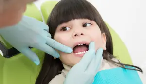 6 Dampak Karies pada Anak, Tak Cuma Bikin Sakit Gigi