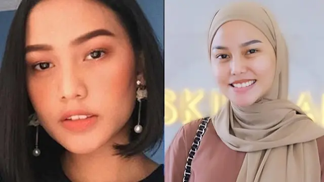 Beda Penampilan 9 Artis Sebelum vs Setelah Operasi Plastik, Bikin Pangling