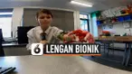 THUMBNAIL bionik