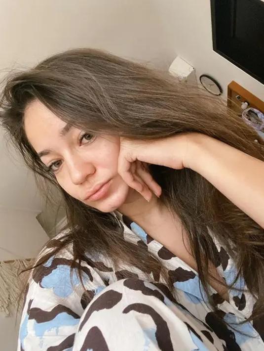 Enzy Storia saat baru bangun tidur ini parasnya menawan. Netizen kompak menyebut Enzy tetap cantik meskipun tak memakai riasa. Potret Enzy dengan muka bantal ini banjir like dan komentar. (Liputan6.com/IG/enzystoria)