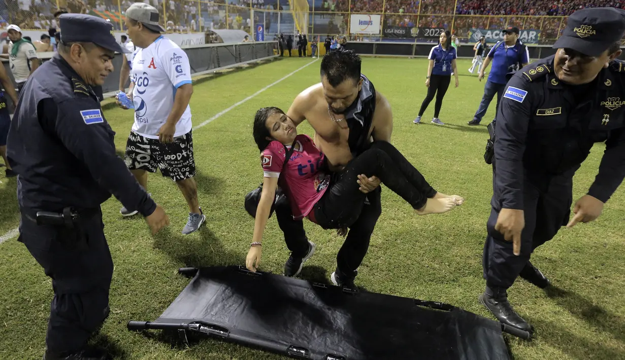 Seorang korban berusaha diletakkan di atas tandu saat terjadi kerusuhan suporter akibat saling berebut masuk ke dalam Stadion Monumental, Cuscatlan, San Salvador, El Salvador, Sabtu (21/5/2023) waktu setempat untuk menyaksikan laga perempatfinal Divisi Utama El Salvador antara Alianza FC menghadapi Deportivo FAS. (AFP/Milton Flores)