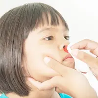 Anak mimisan/copyright: shuterstock