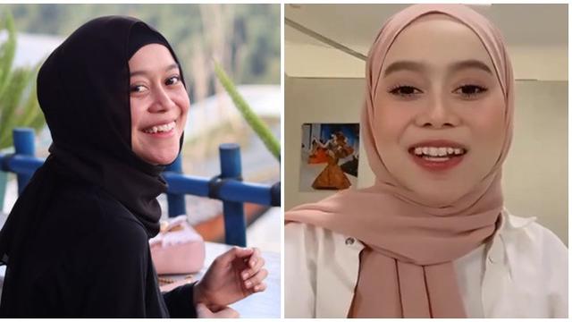 6 Beda Gaya Lesti Kejora Sebelum vs Sesudah Pakai Behel, Hilangkan Gingsul