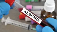Fungsi Albumin dalam Tubuh dan Bahayanya Apabila Kekurangan