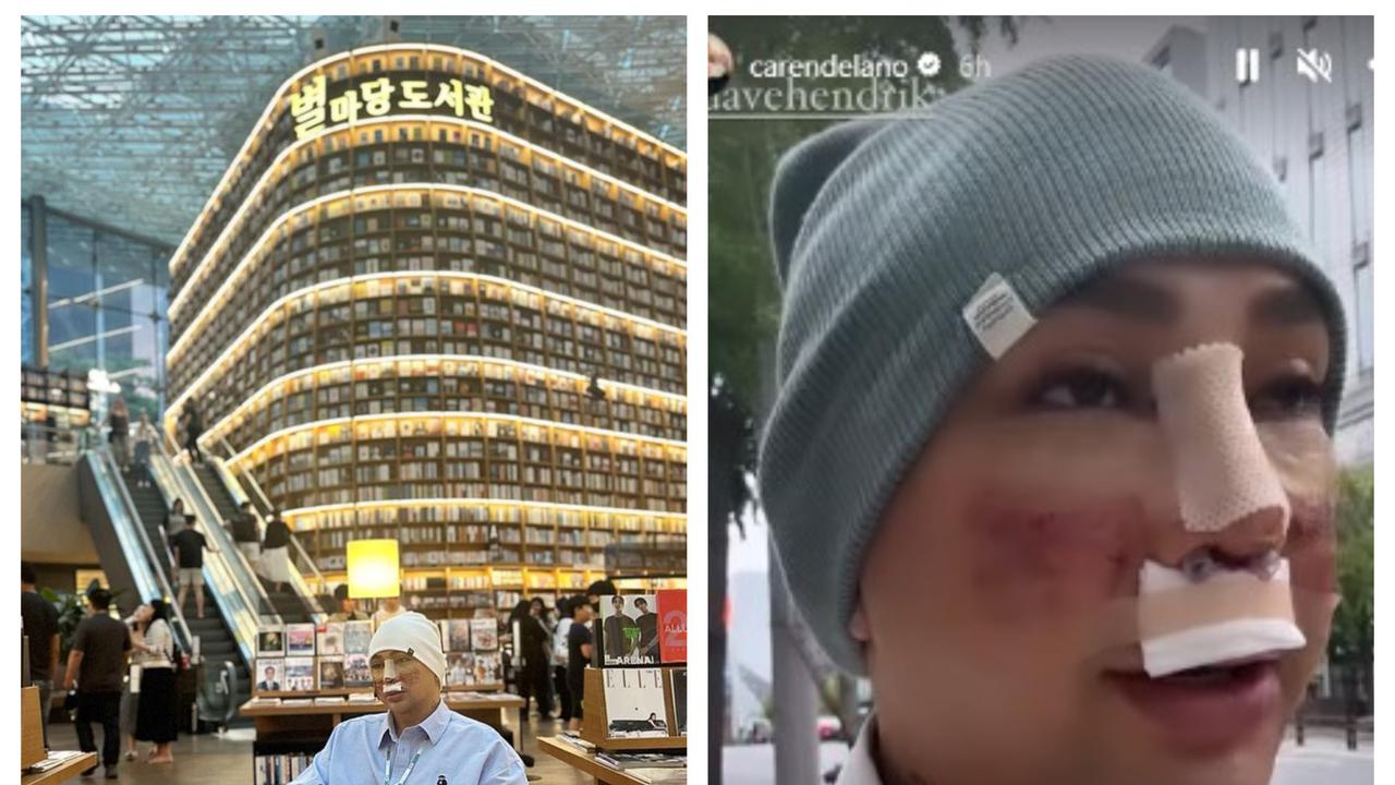 Potret Caren Delano Jalan-Jalan di Korea Usai Oplas, Wajah Masih Diperban