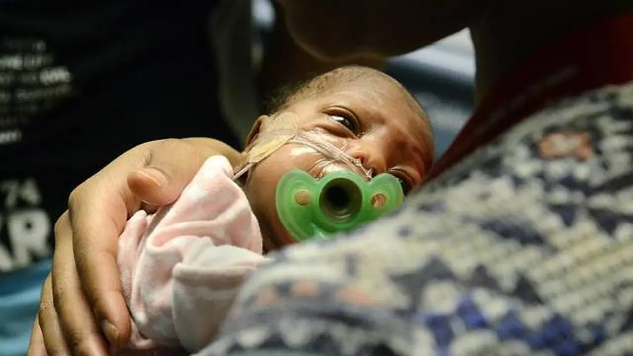 Berat Tubuh Tak Sampai 1 kg, Bayi Ini Tetap Berjuang Hidup