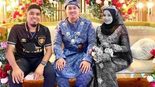 Sehari Setelah Menikah, Istri Pria Ini Meninggal Karena Pendarahan di Otak