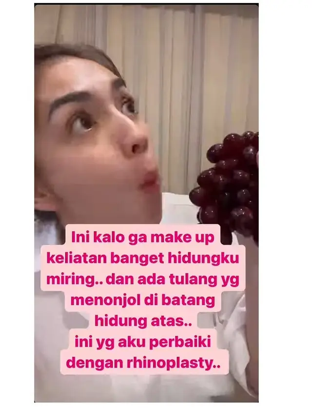 8 Potret Angel Karamoy Sebelum vs Setelah Operasi Plastik, Hasilnya Disebut Natural