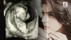Carissa Puteri mengunggah foto hasil USG kandungannya yang kedua di Instagram.