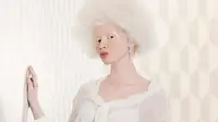 Thando Hopa, Model Albino Mendunia karena Banyak Prestasi