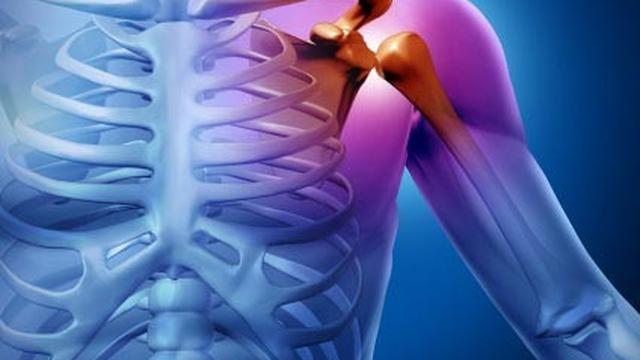 Baca Ini Jika Anda Sering Nyeri Sendi