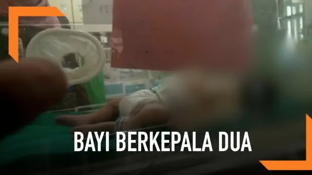 Seorang ibu di Brebes, Jawa Tengah melahirkan bayi berkepala dua. Pihak keluarga mengaku pasrah atas kelahiran bayi tersebut karena harus dirujuk ke rumah sakit di Semarang.