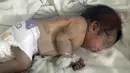 Seorang bayi perempuan yang lahir di bawah reruntuhan akibat gempa bumi yang melanda Suriah dan Turki menerima perawatan di dalam inkubator di rumah sakit anak di kota Afrin, provinsi Aleppo, Suriah, Selasa (7/2/2023). Di dalam inkubator di rumah sakit di Afrin, bayi yang baru lahir tersebut dihubungkan ke infus, tubuhnya terluka, dan perban melilit tangan kirinya. (AP Photo/Ghaith Alsayed)