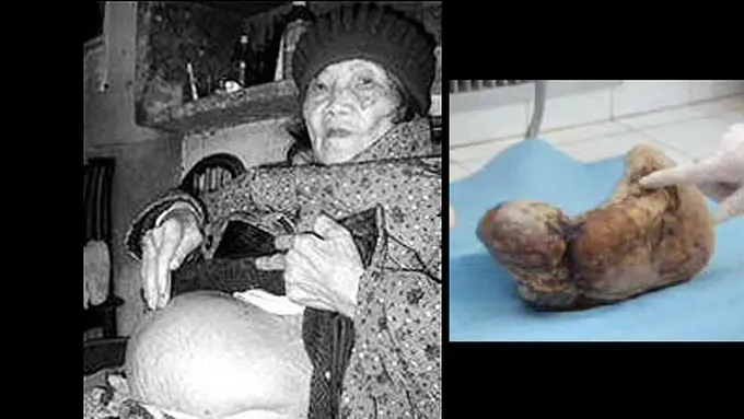 Foto: weirdasianews.com